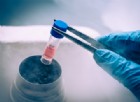 Cellule staminali: cosa sono e perch potrebbero salvare la vita di molte persone