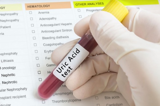acido urico farmacia alimentos donde se encuentra acido urico tratamiento para la gota pdf
