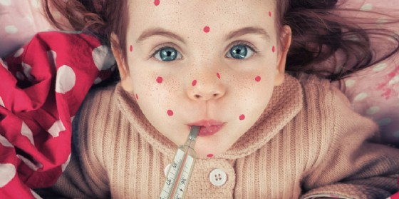 Morbillo: in Fvg non si registra un aumento significativo dei casi (© AdobeStock | johnwilhelm) Morbillo: in Fvg non si registra un aumento significativo dei casi (© AdobeStock | johnwilhelm)