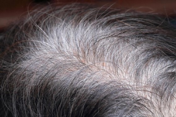 Uomini, legame tra capelli bianchi e rischio cardiaco Uomini, legame tra capelli bianchi e rischio cardiaco