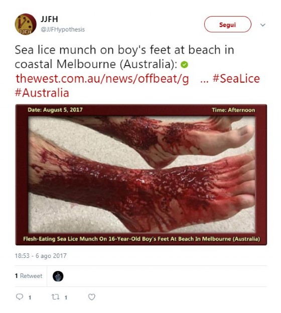 Il tweet che l'immagine delle gambe di Sam morsicate