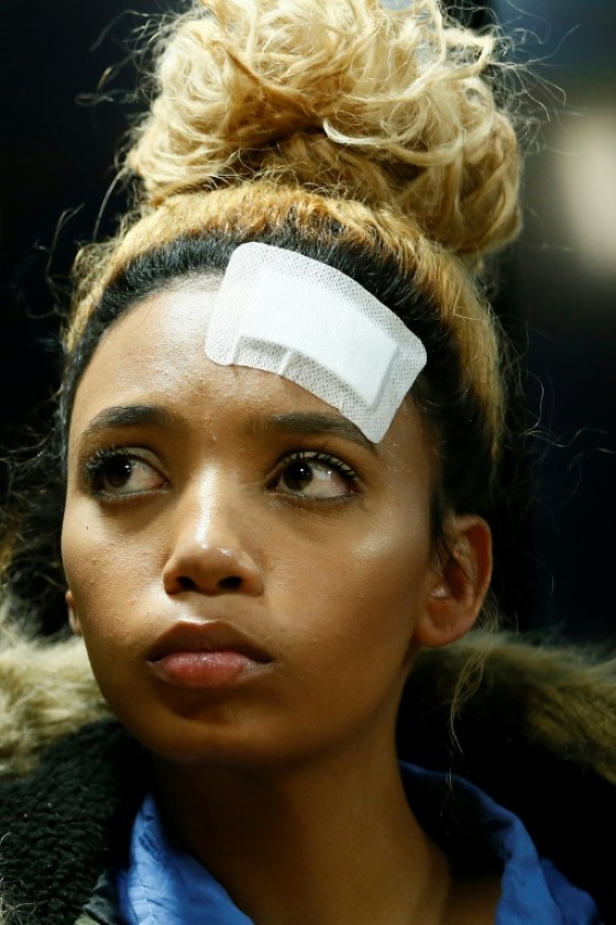 South African model Gabriella Engels has accused Grace Mugabe of attacking her with an electrical extension cord in a Johannesburg hotel.