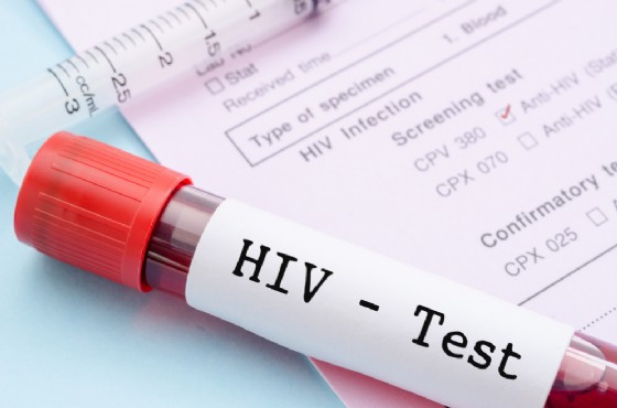 Valentino Talluto contagiò donne con hiv Valentino Talluto contagiò donne con hiv