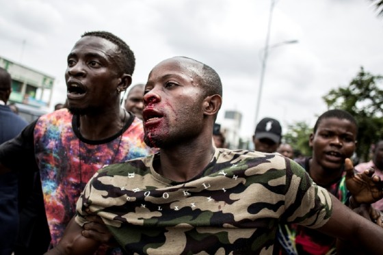 A young man was injured in the face after police fired warning shots to disperse worshippers outside Kinshasa cathedral