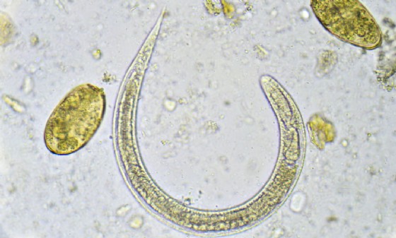 Il nematode Strongyloides stercoralis al microscopio