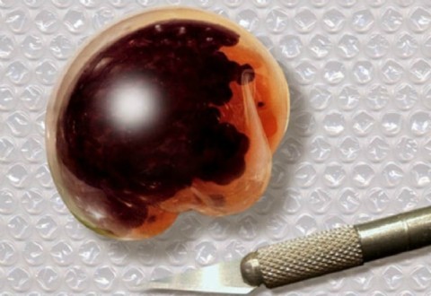 Cyber egg