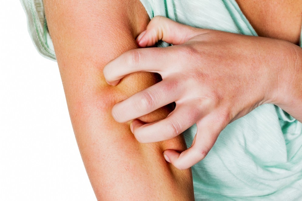 Psoriasi, un farmaco ha dato buoni risultati