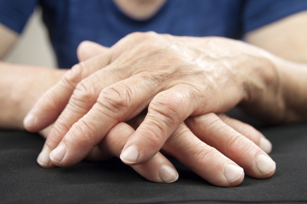 Artrite reumatoide, la serotonina gioca un ruolo importante
