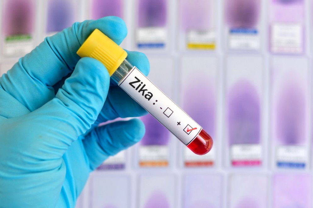 Zika virus, il rischio c' ed  meglio prevenire