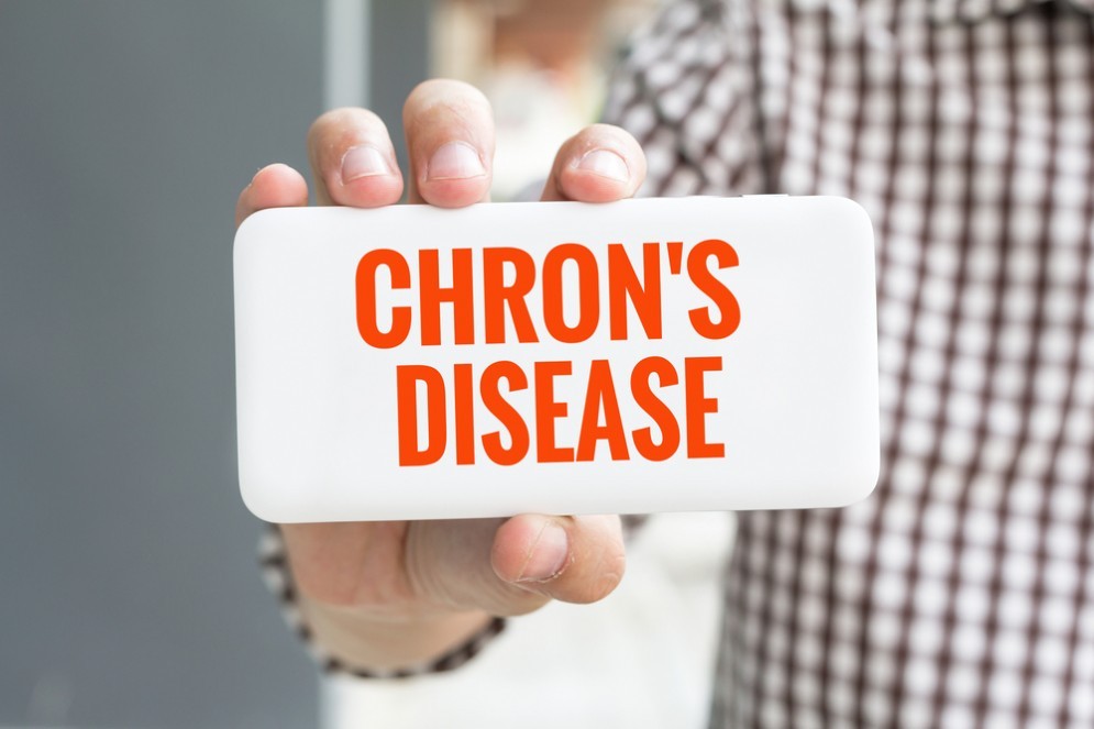 Morbo di Crohn, un gene la chiave per la realizzazione di nuovi farmaci