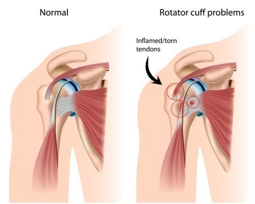 Anatomia della cuffia dei rotatori