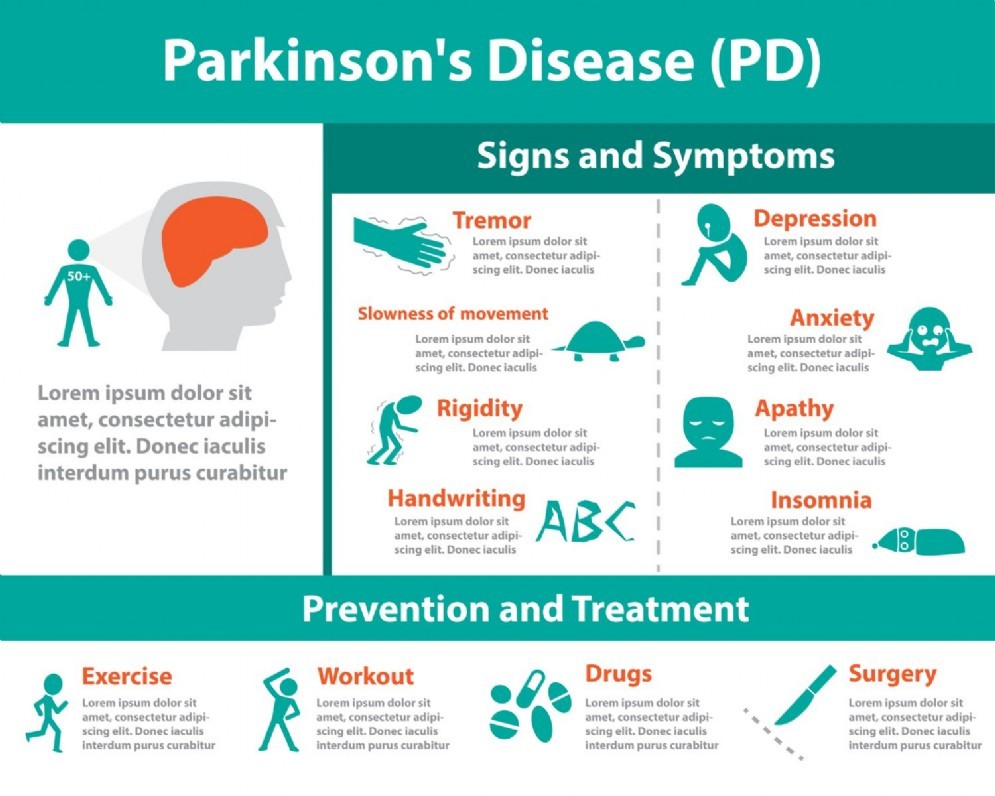 La malattia di Parkinson