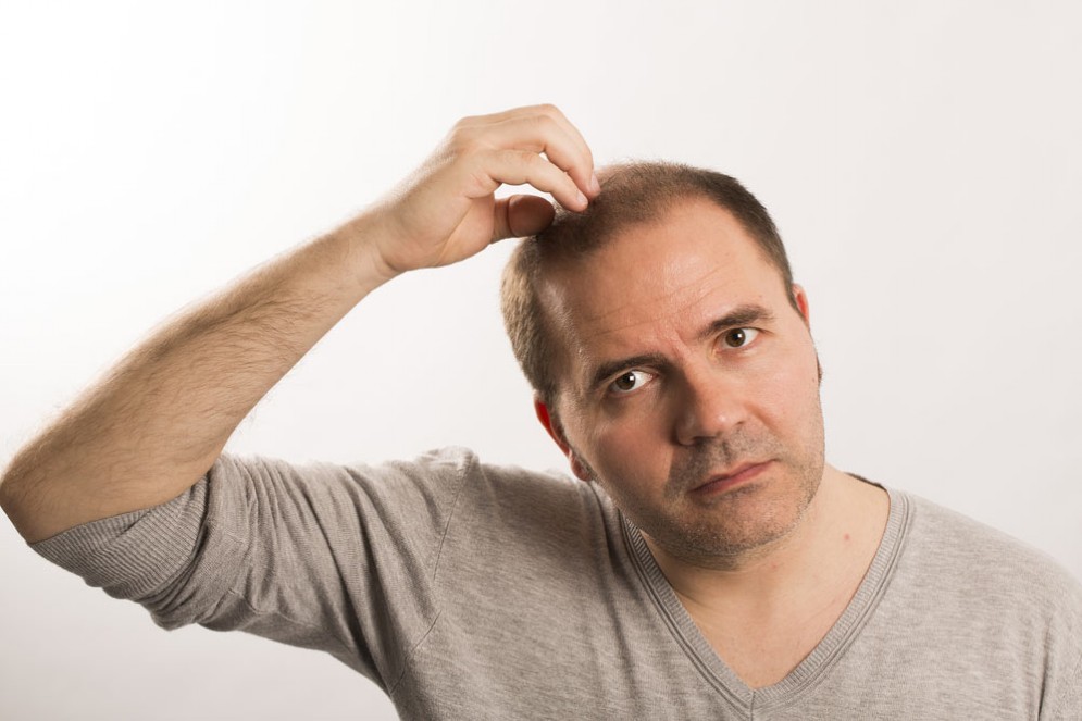 Sredstva contro una perdita di capelli
