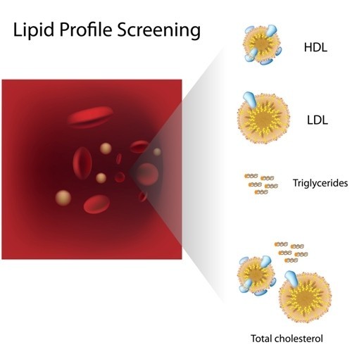 Profilo lipidico completo