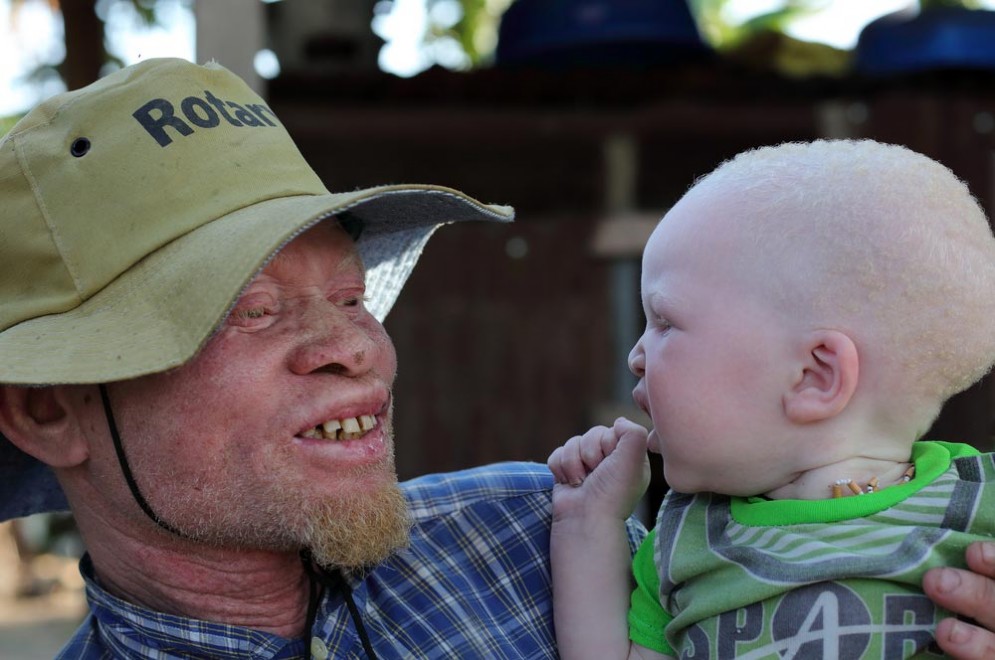 Un albino in Africa