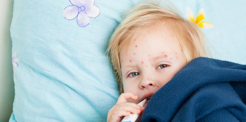 Morbillo, sempre pi casi e c' anche chi cerca un untore su Facebook
