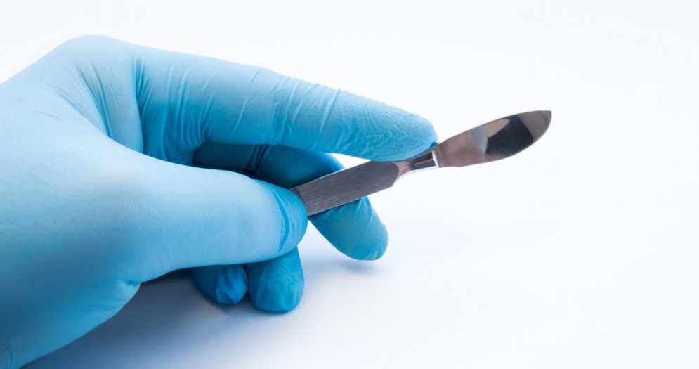 Le 7 cose più incredibili che i chirurghi hanno rimosso dal corpo di un paziente