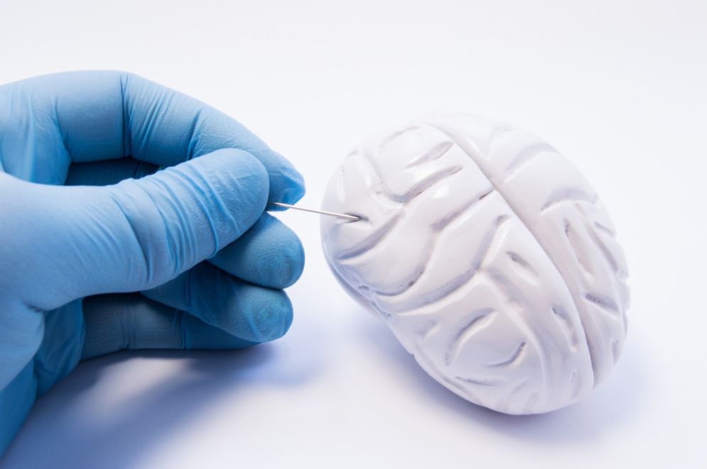 Diagnosi precoce del morbo di Parkinson e demenza