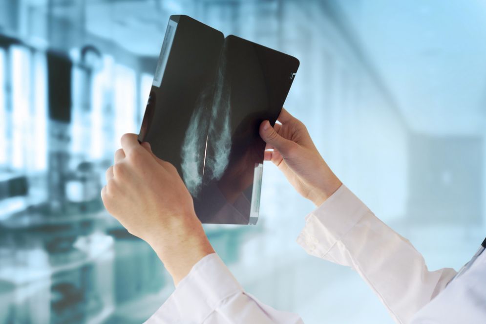 Centinaia di donne morta di cancro per un errore del pc?