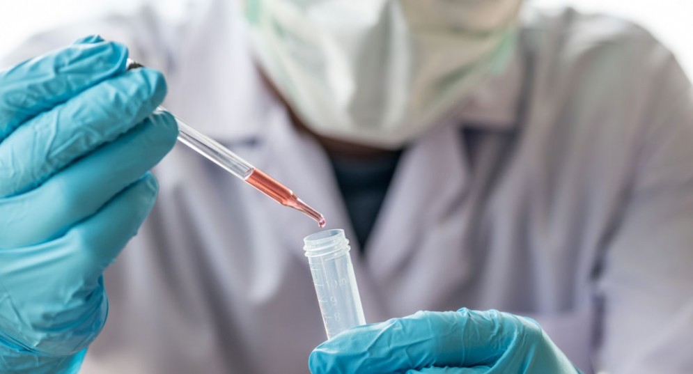 Test del sangue