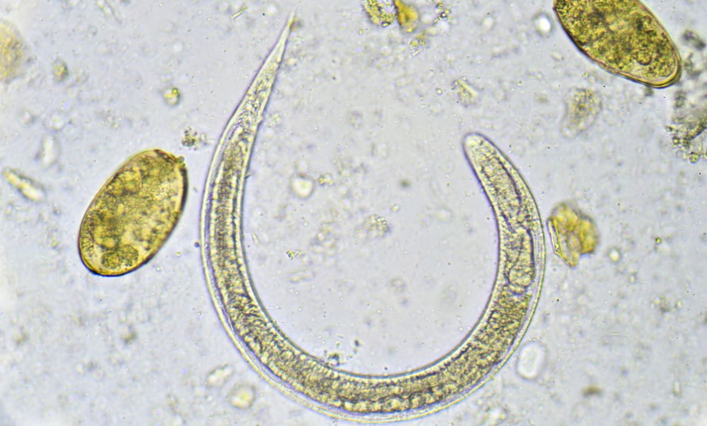 Il nematode Strongyloides stercoralis al microscopio