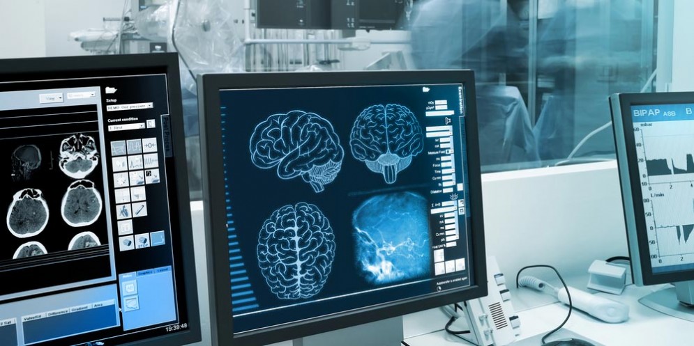 Cervello e glioblastoma