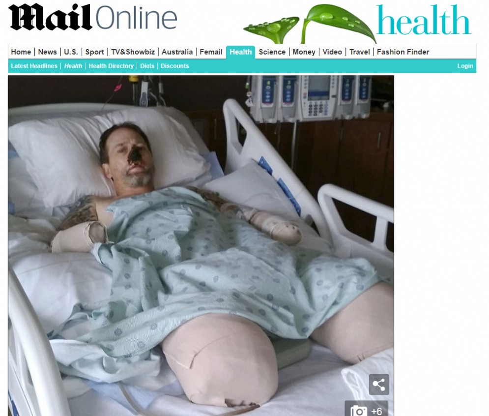 Screenshot dell'articolo con le immagini di Greg