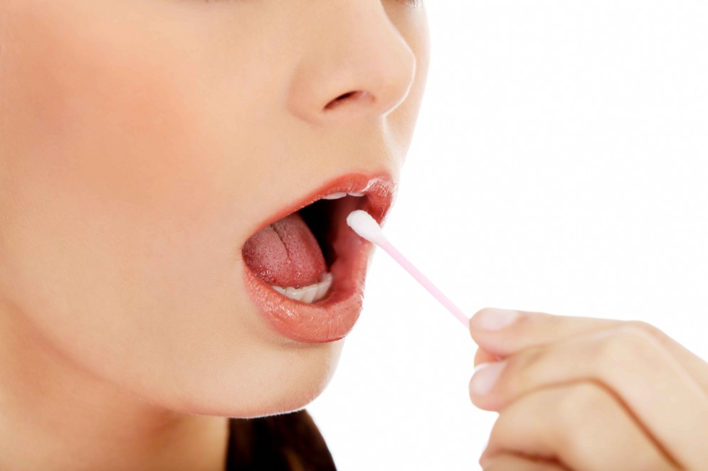 Un campione di saliva per predire il rischio di infarto