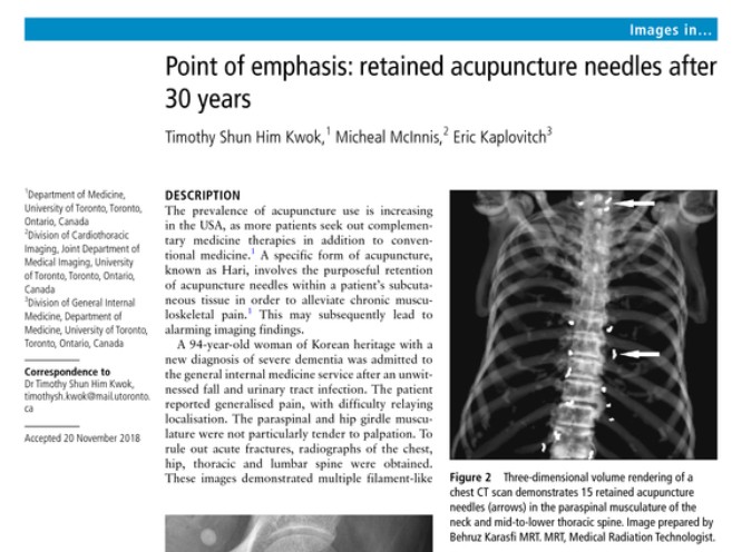 Il caso riportato sul BMJ Case Reports